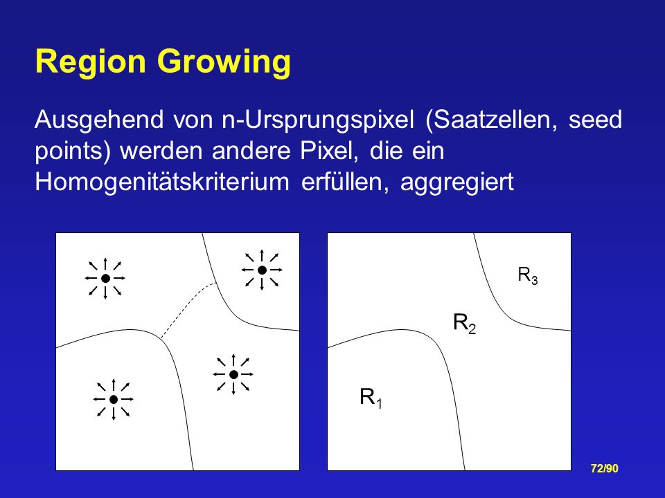 Region Growing Ausgehend von n-Ursprungspixel (Saatzellen, seed points) werden andere Pixel, die ein Homogenitätskriterium erfüllen, aggregiert.