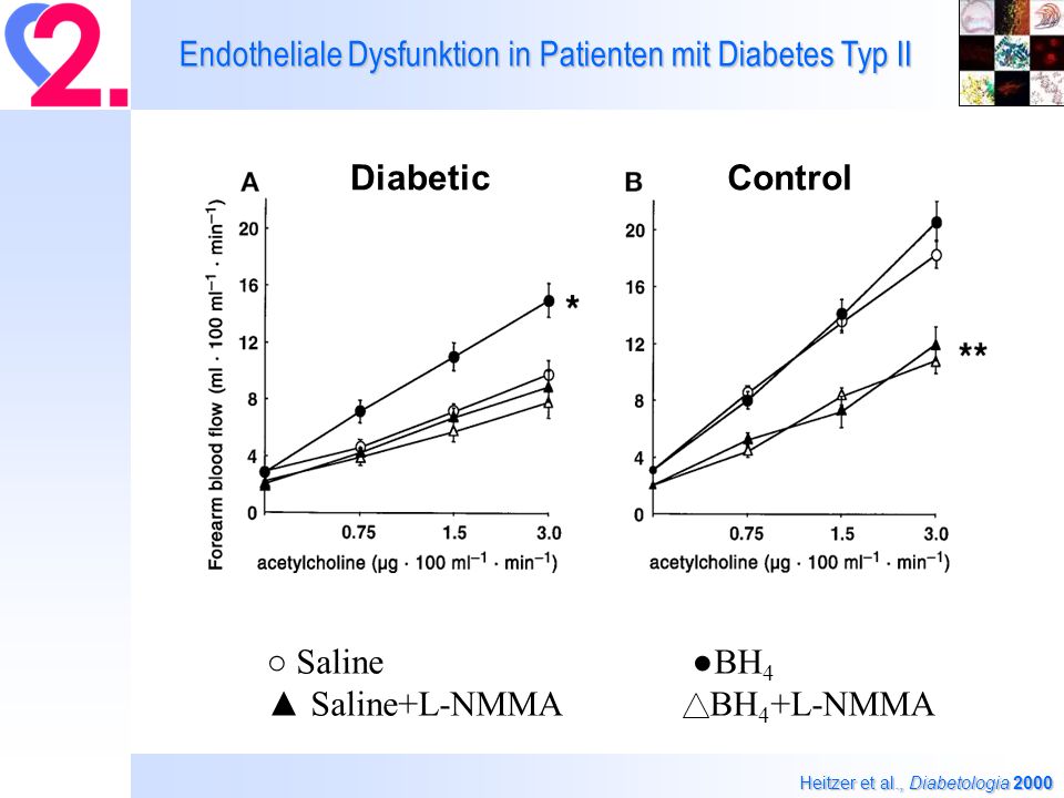 Endotheliale Dysfunktion in Patienten mit Diabetes Typ II