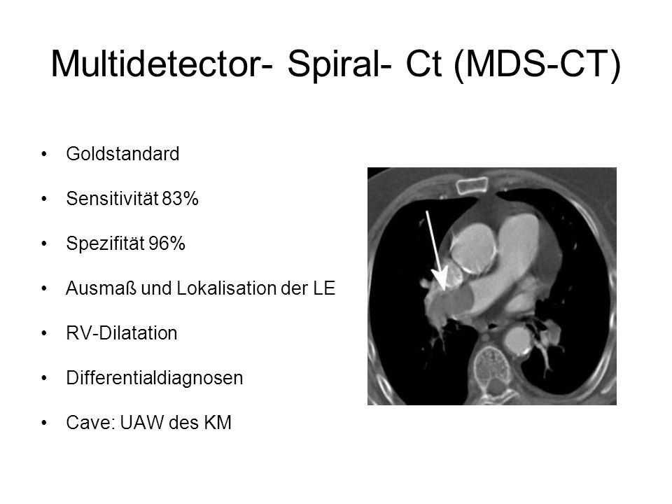 Multidetector- Spiral- Ct (MDS-CT)