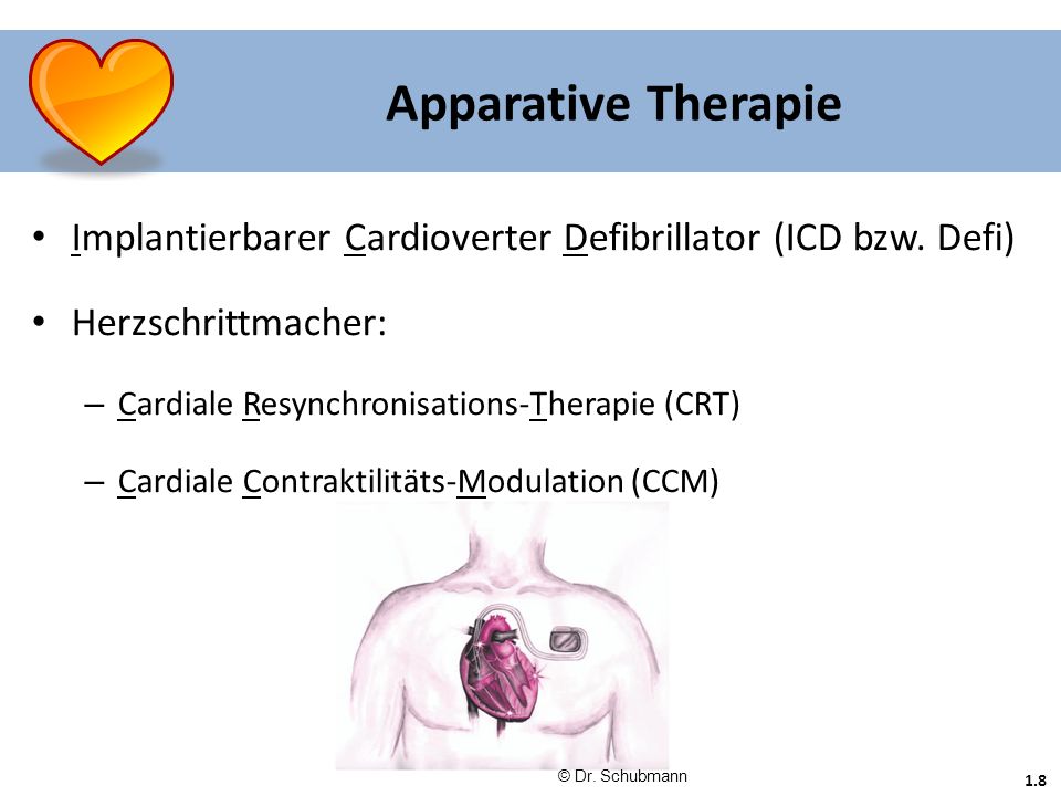 Apparative Therapie Implantierbarer Cardioverter Defibrillator (ICD bzw. Defi) Herzschrittmacher: Cardiale Resynchronisations-Therapie (CRT)
