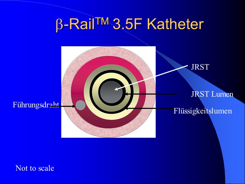 -RailTM 3.5F Katheter JRST JRST Lumen Führungsdraht Flüssigkeitslumen