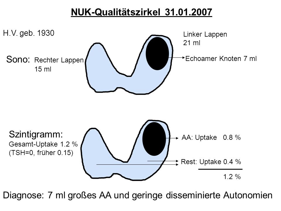 NUK-Qualitätszirkel Sono: Rechter Lappen Szintigramm: