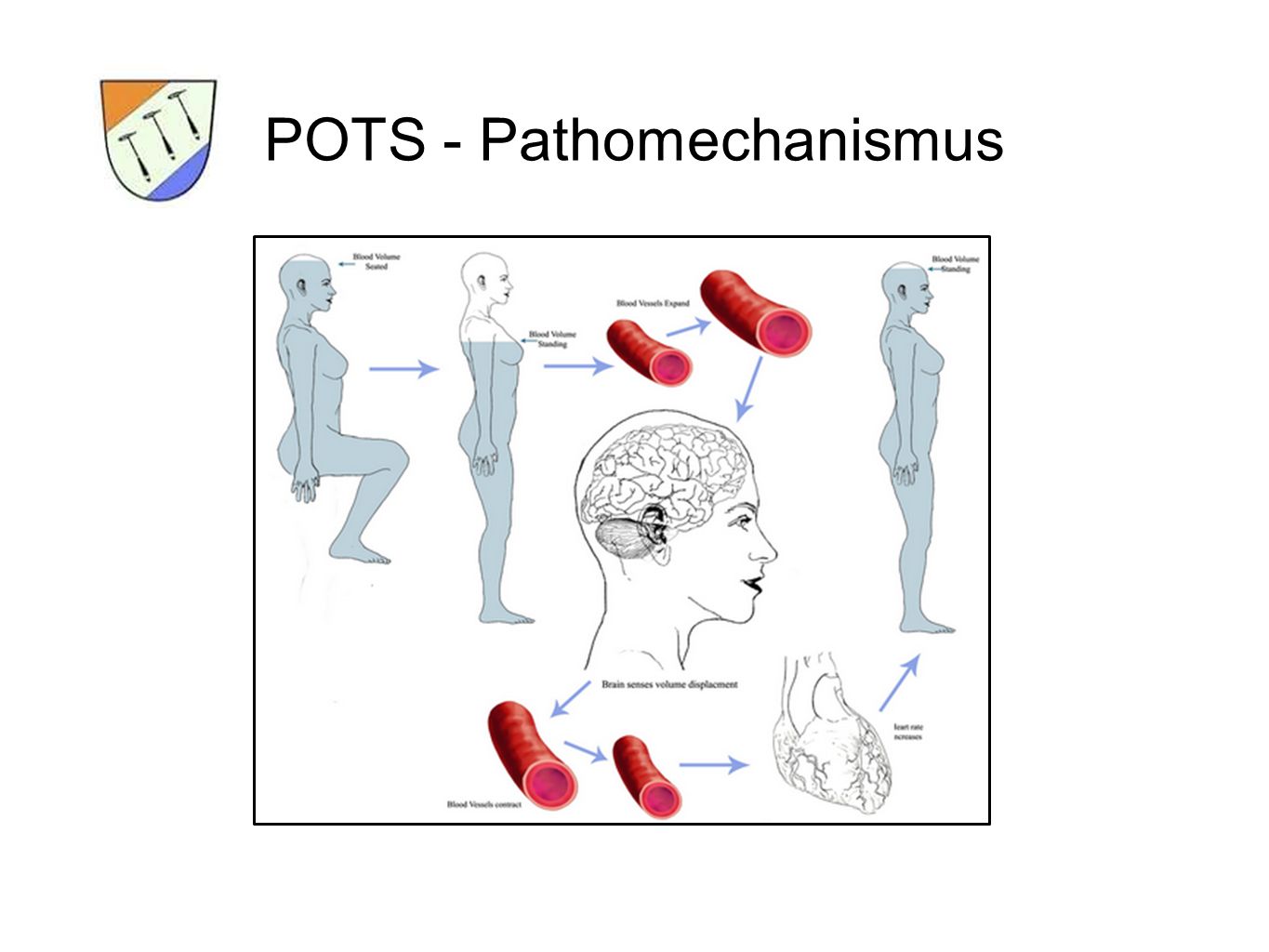 POTS - Pathomechanismus
