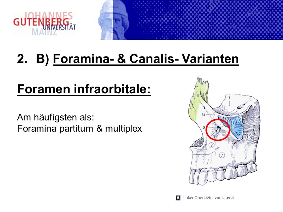 B) Foramina- & Canalis- Varianten Foramen infraorbitale: