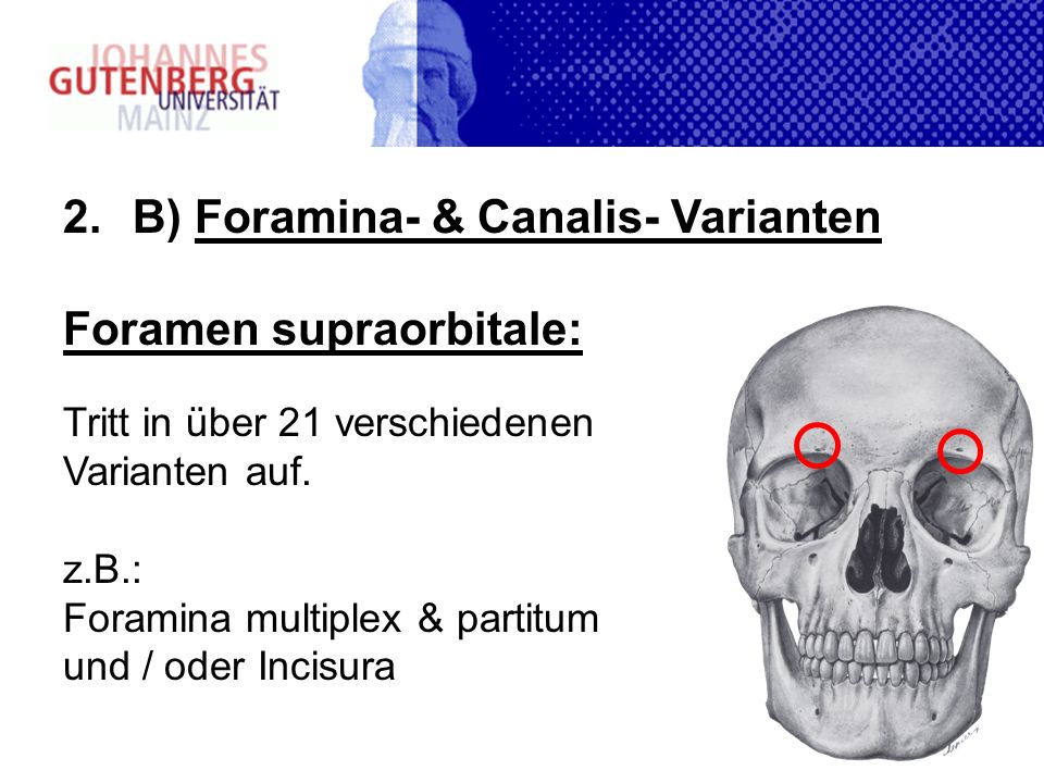 B) Foramina- & Canalis- Varianten Foramen supraorbitale: