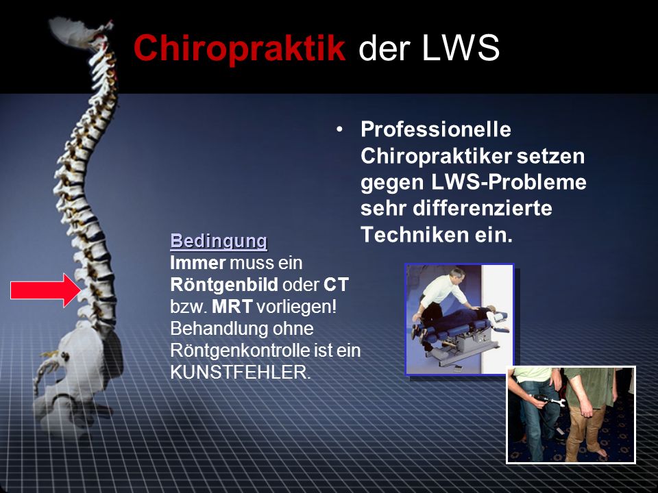 Chiropraktik der LWS Professionelle Chiropraktiker setzen gegen LWS-Probleme sehr differenzierte Techniken ein.