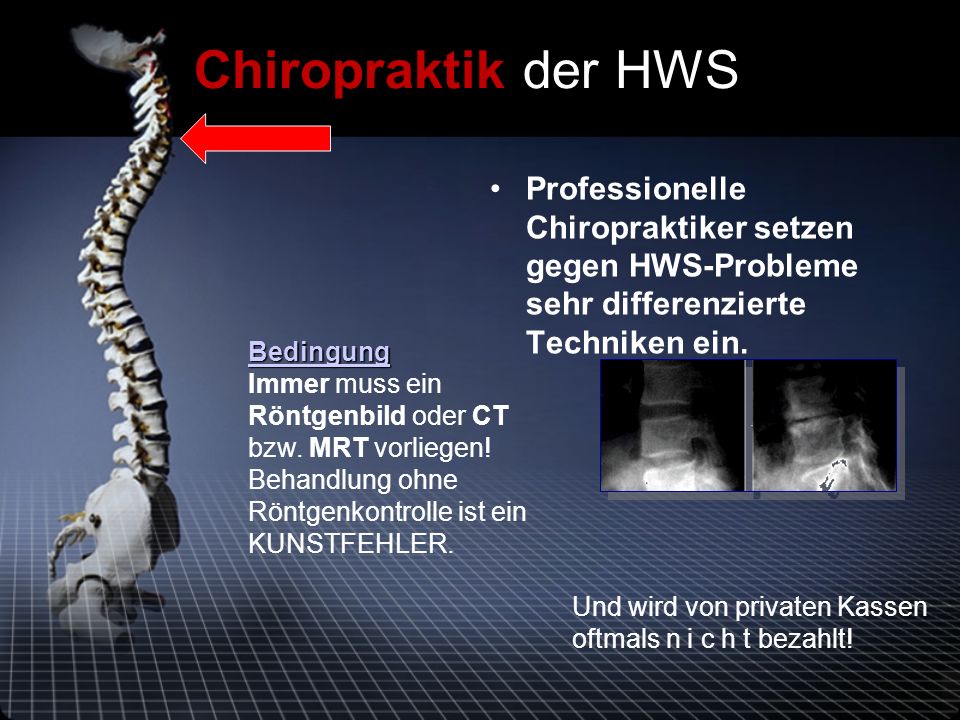 Chiropraktik der HWS Professionelle Chiropraktiker setzen gegen HWS-Probleme sehr differenzierte Techniken ein.