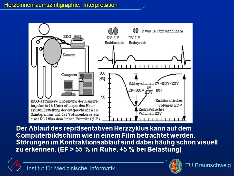 Herzbinnenraumszintigraphie: Interpretation