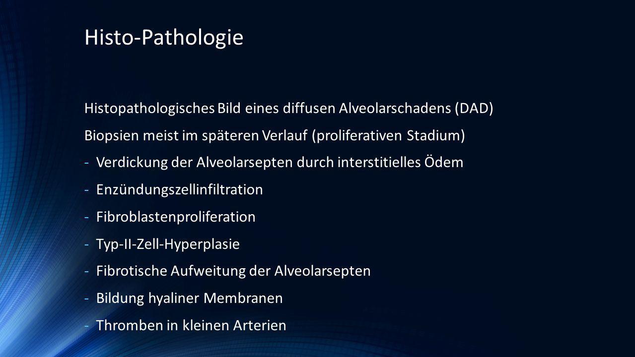 Histo-Pathologie Histopathologisches Bild eines diffusen Alveolarschadens (DAD) Biopsien meist im späteren Verlauf (proliferativen Stadium)