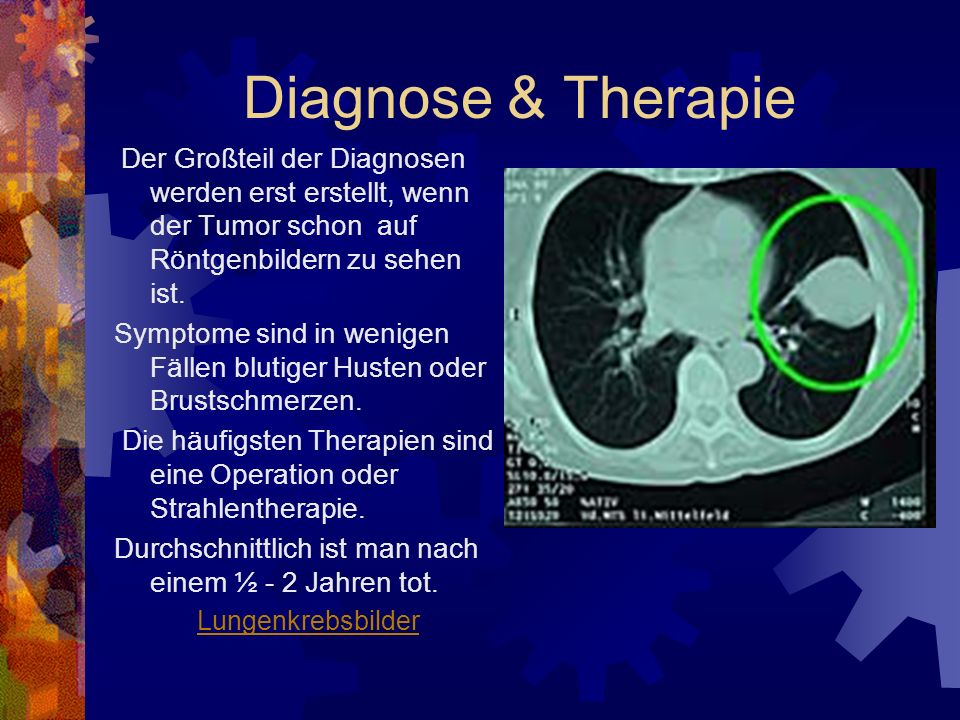 Diagnose & Therapie Der Großteil der Diagnosen werden erst erstellt, wenn der Tumor schon auf Röntgenbildern zu sehen ist.