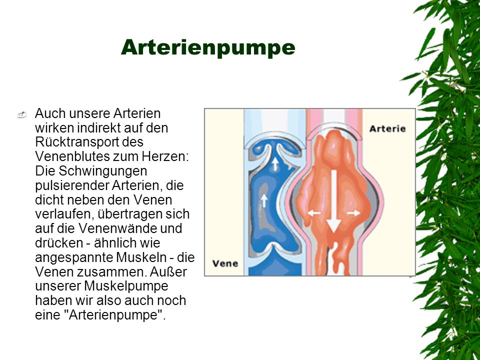 Arterienpumpe