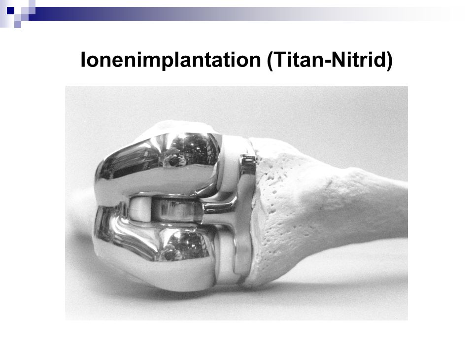 Ionenimplantation (Titan-Nitrid)