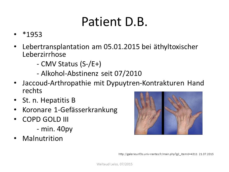 Patient D.B. *1953. Lebertransplantation am bei äthyltoxischer Leberzirrhose. - CMV Status (S-/E+)