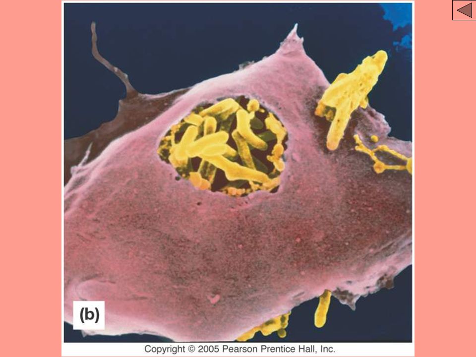 Figure: 32-3 part b Title: The attack of the macrophages part b. Caption: