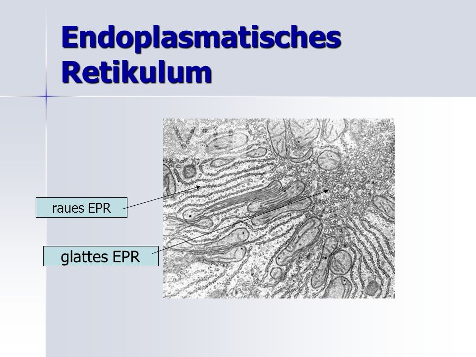 Endoplasmatisches Retikulum