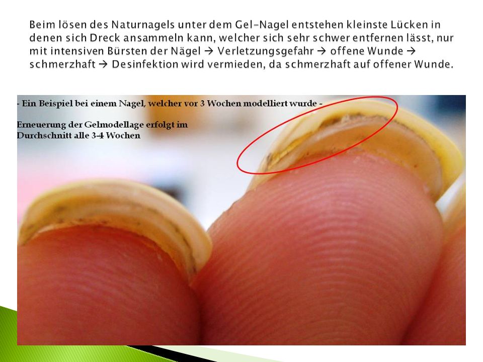 Beim lösen des Naturnagels unter dem Gel-Nagel entstehen kleinste Lücken in denen sich Dreck ansammeln kann, welcher sich sehr schwer entfernen lässt, nur mit intensiven Bürsten der Nägel  Verletzungsgefahr  offene Wunde  schmerzhaft  Desinfektion wird vermieden, da schmerzhaft auf offener Wunde.