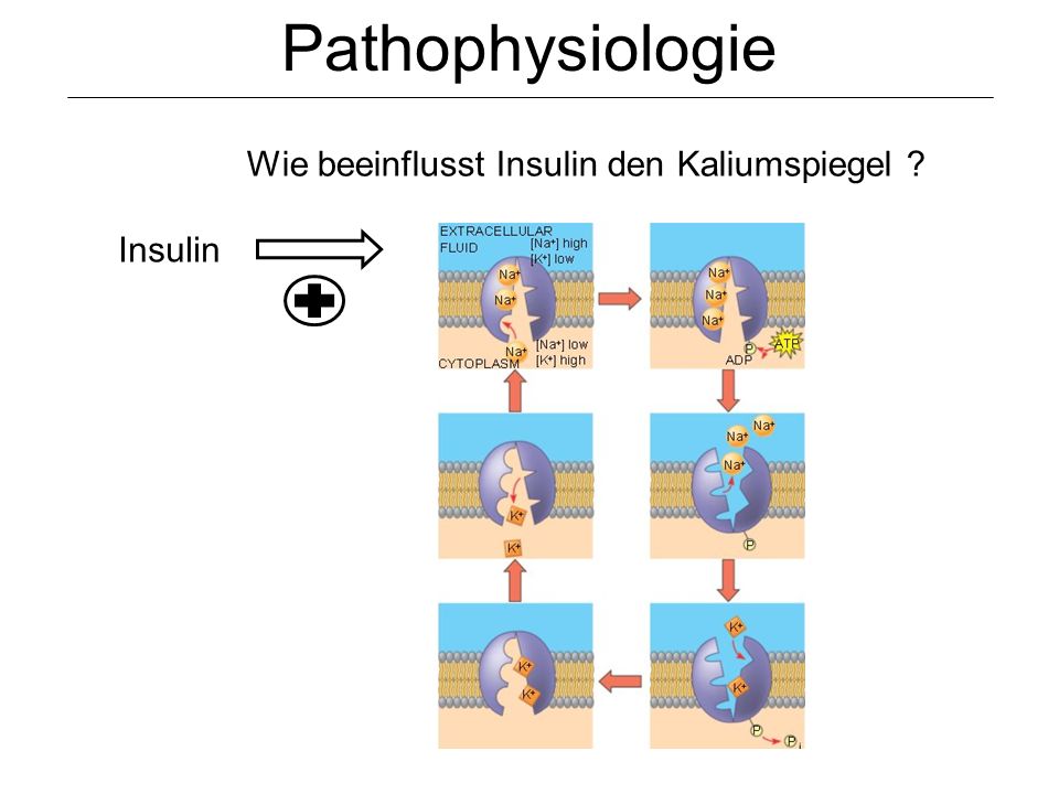 Pathophysiologie Wie beeinflusst Insulin den Kaliumspiegel Insulin