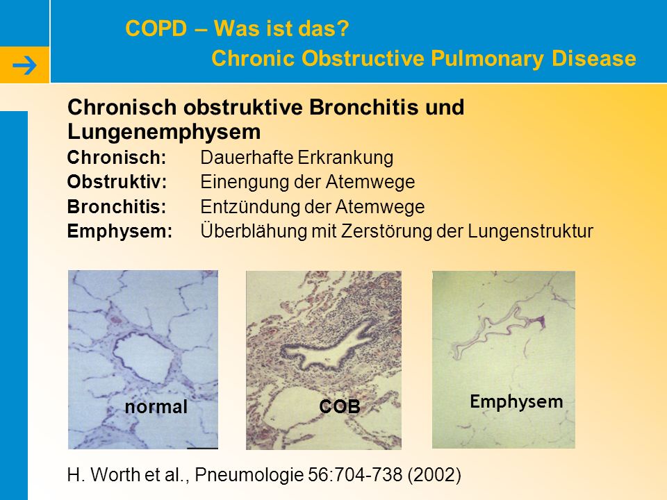 COPD – Was ist das Chronic Obstructive Pulmonary Disease
