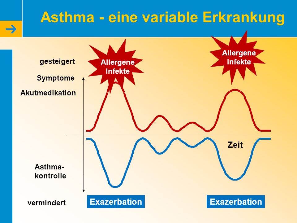 Asthma - eine variable Erkrankung