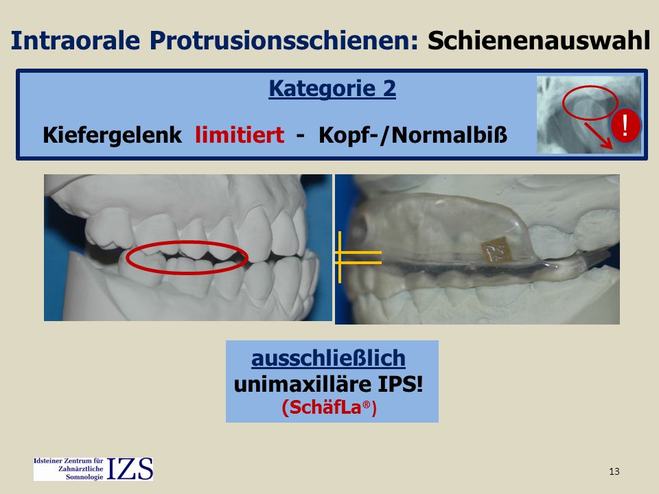 ! Intraorale Protrusionsschienen: Schienenauswahl Kategorie 2