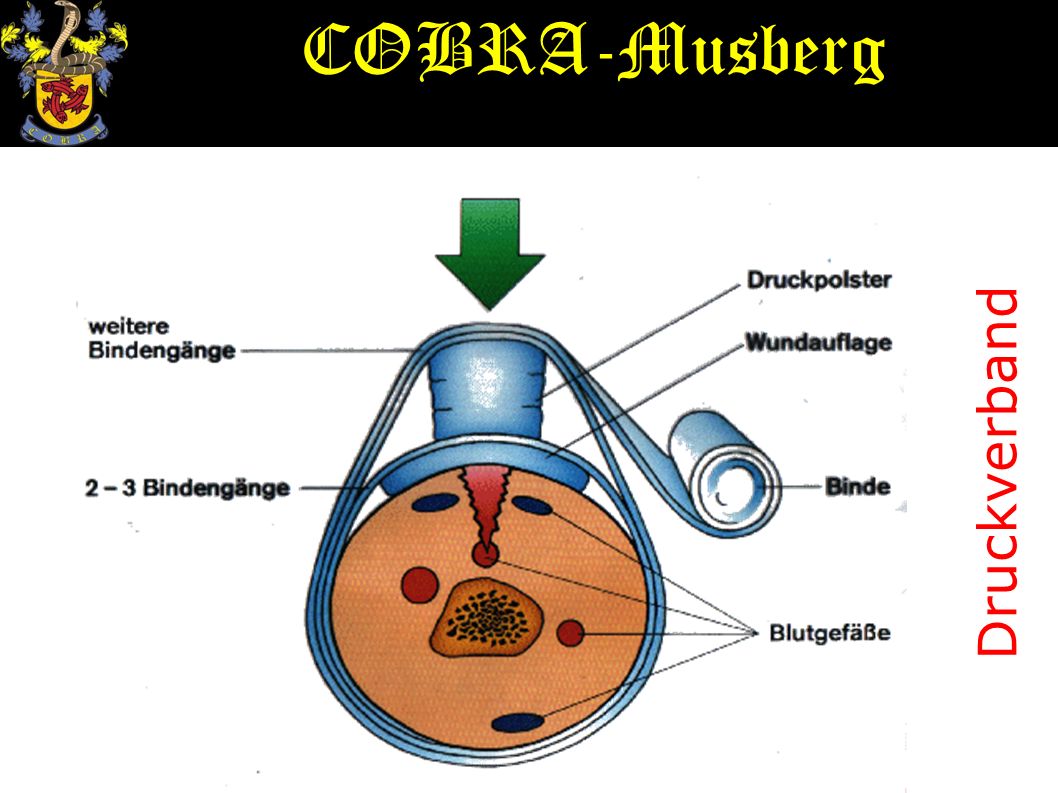 COBRA-Musberg Druckverband
