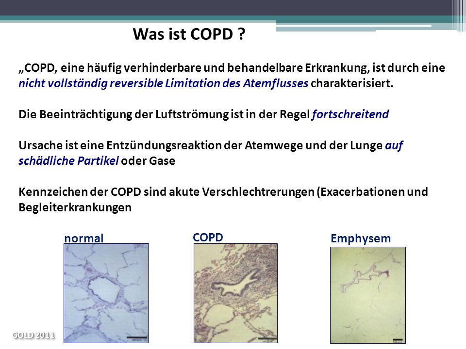 Was ist COPD