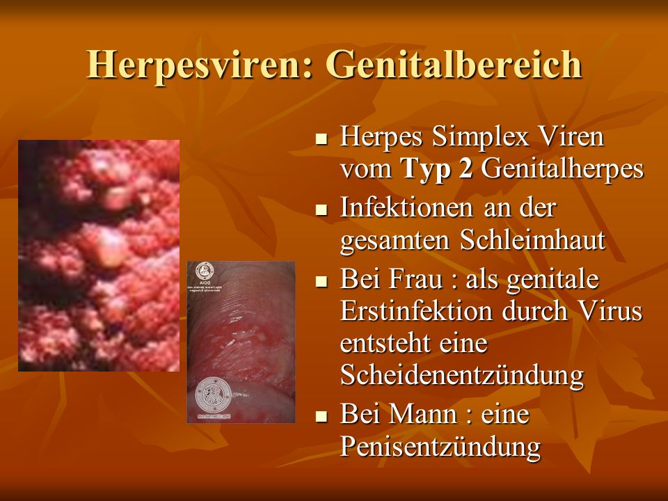 Frau genitalherpes Genital Herpes: