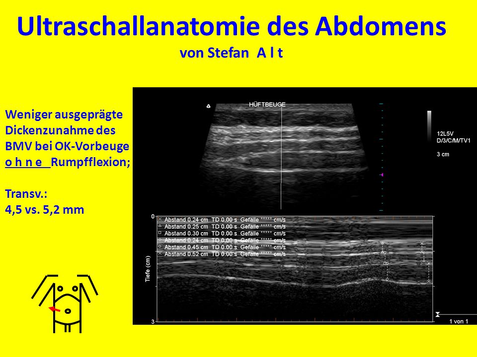 Ultraschallanatomie des Abdomens von Stefan A l t