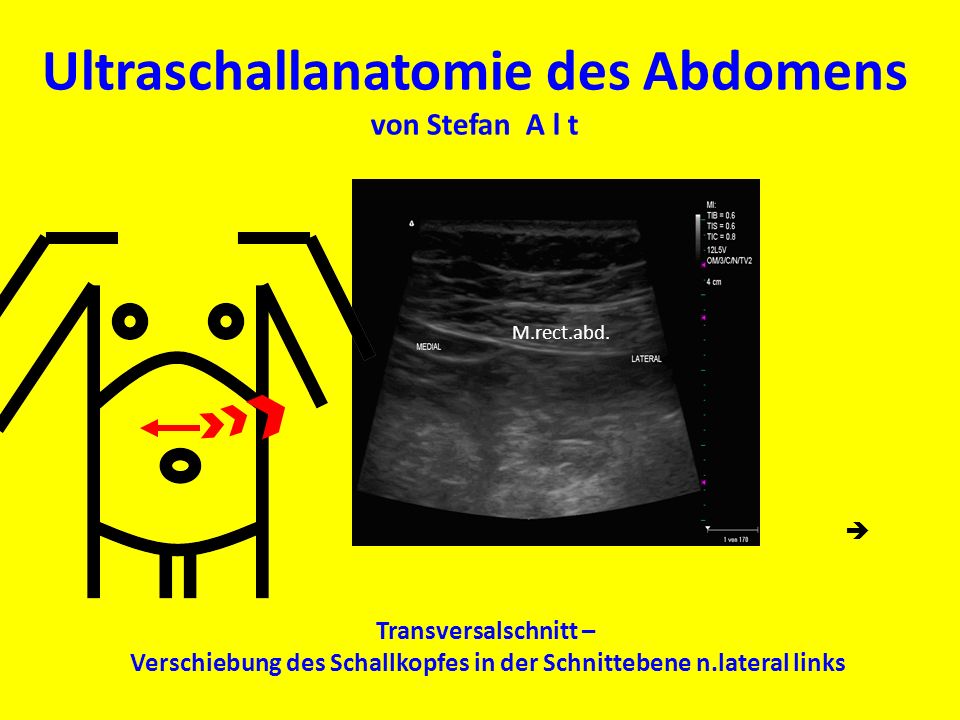 Ultraschallanatomie des Abdomens von Stefan A l t