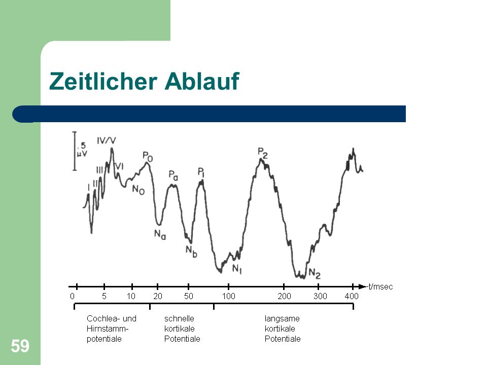 Zeitlicher Ablauf Nach bisherigem Erkenntnisstand sind folgende Hirnstammkerne für die Wellen I bis IV verantwortlich: