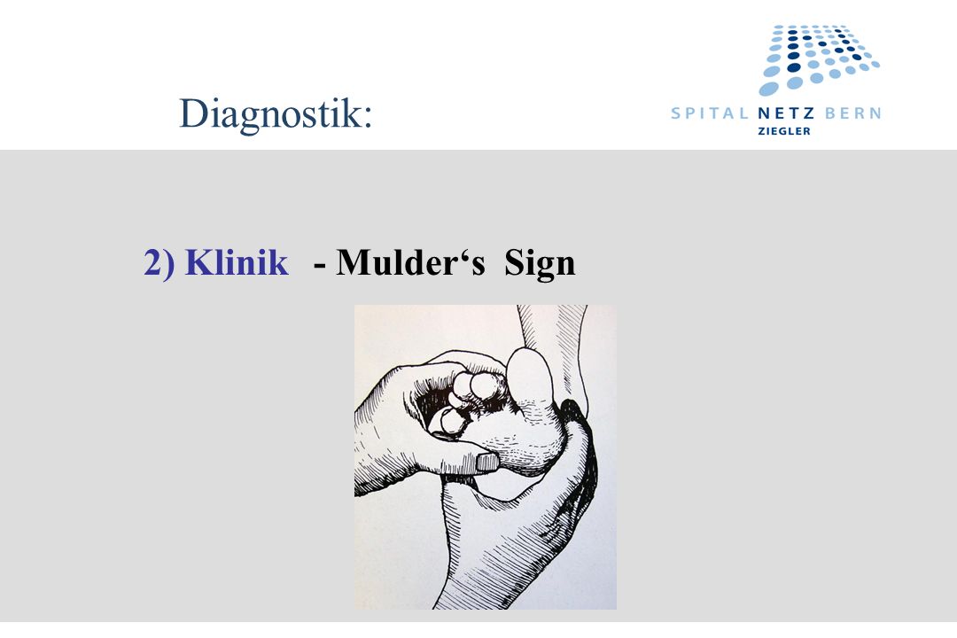 Diagnostik: 2) Klinik - Mulder‘s Sign