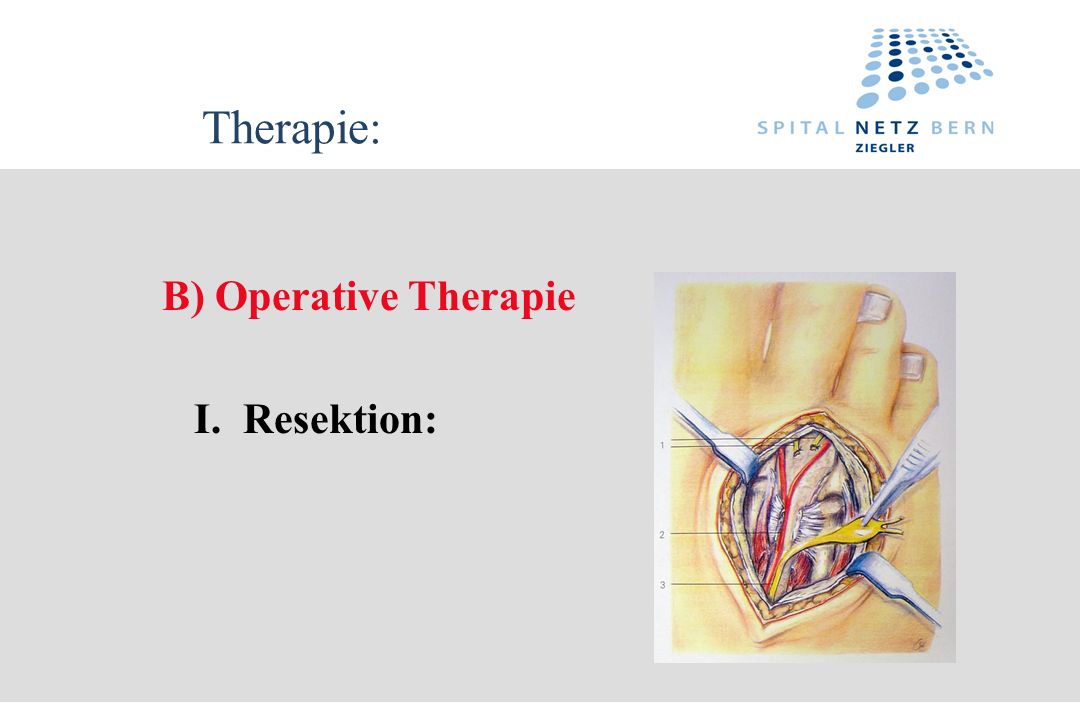 Therapie: B) Operative Therapie I. Resektion: