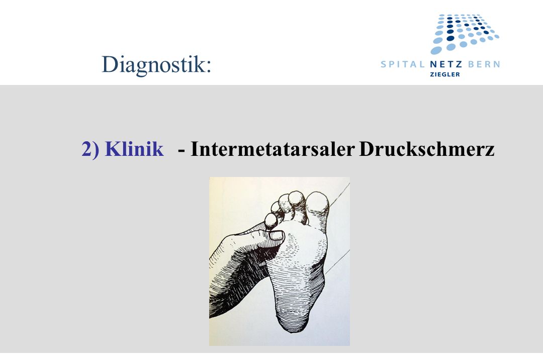 Diagnostik: 2) Klinik - Intermetatarsaler Druckschmerz