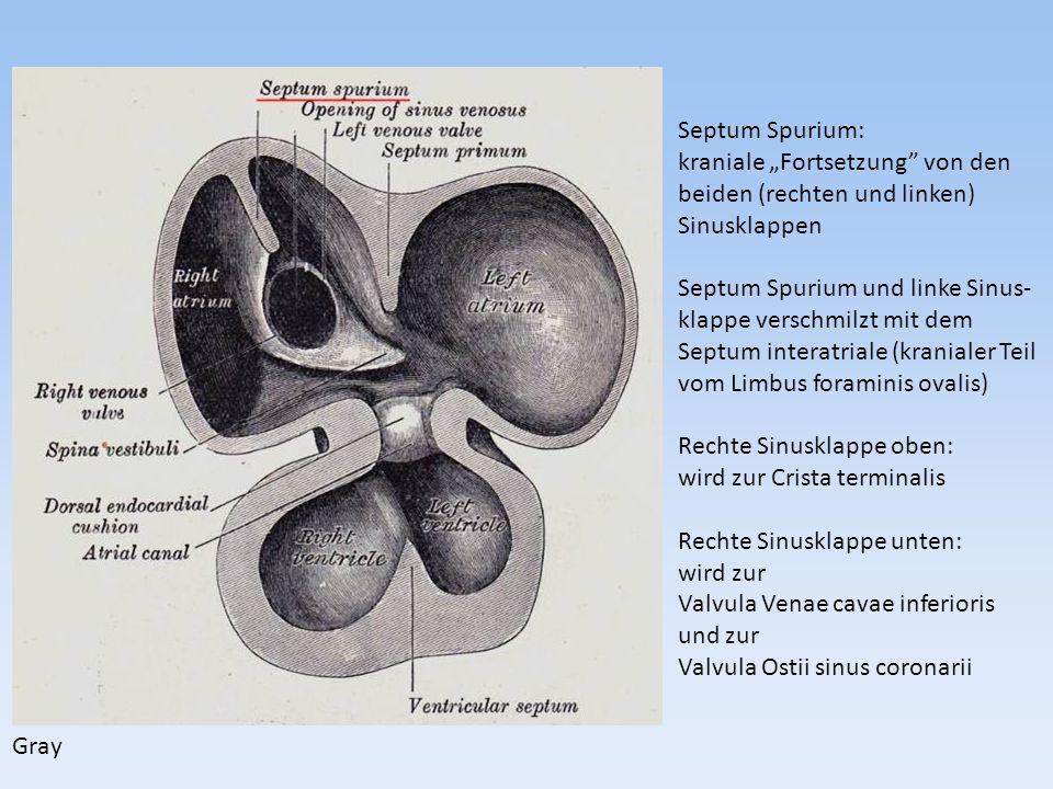 Septum Spurium: kraniale „Fortsetzung von den. beiden (rechten und linken) Sinusklappen. Septum Spurium und linke Sinus-