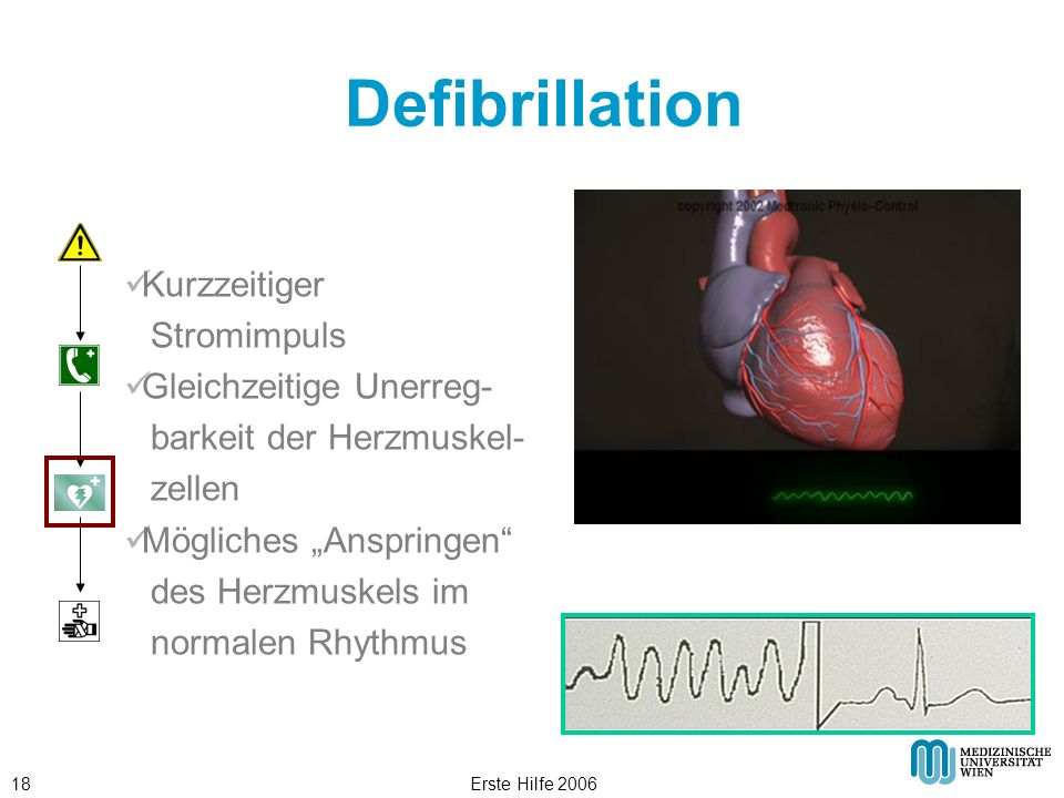 Defibrillation Kurzzeitiger Stromimpuls Gleichzeitige Unerreg-