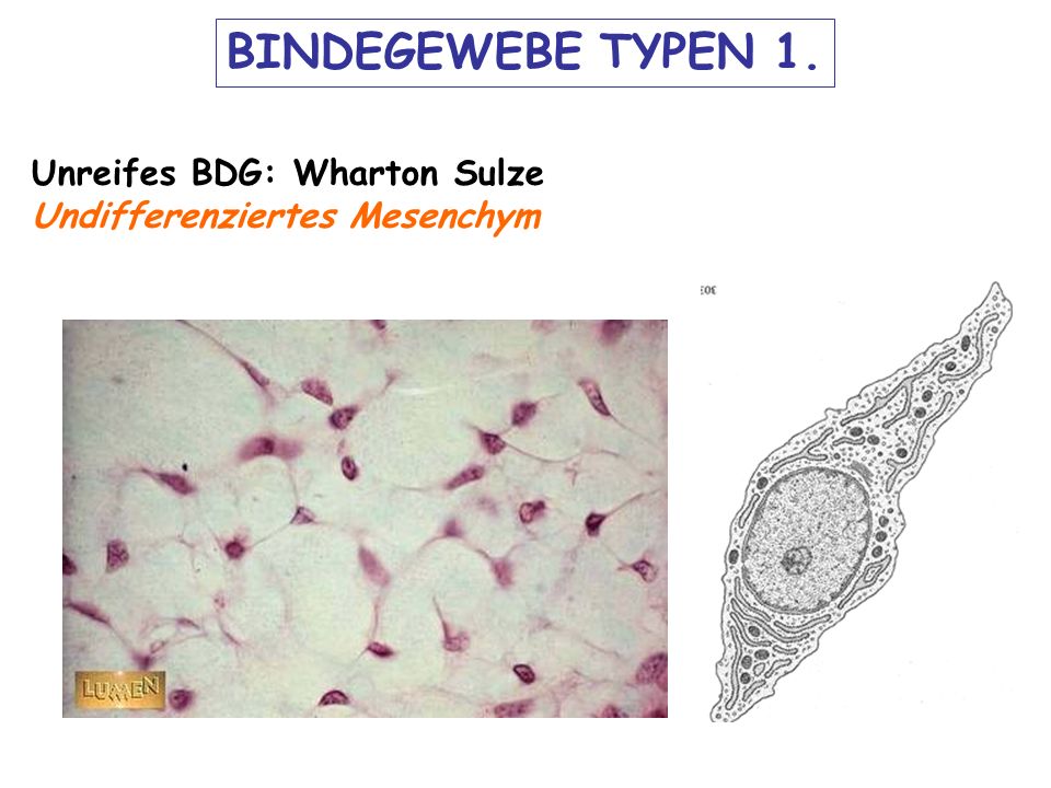 BINDEGEWEBE TYPEN 1. Unreifes BDG: Wharton Sulze
