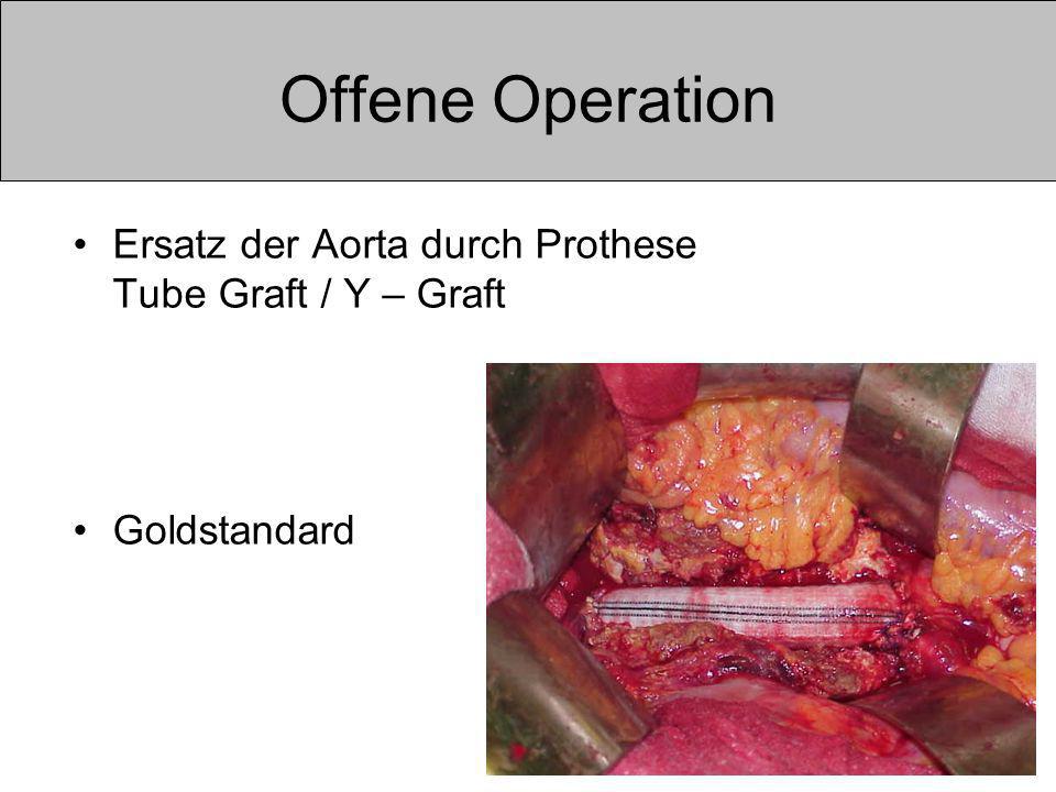Offene Operation Ersatz der Aorta durch Prothese Tube Graft / Y – Graft Goldstandard
