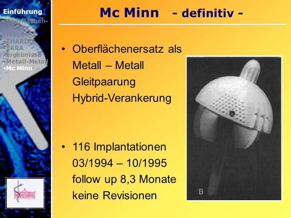 Mc Minn - definitiv - Oberflächenersatz als Metall – Metall