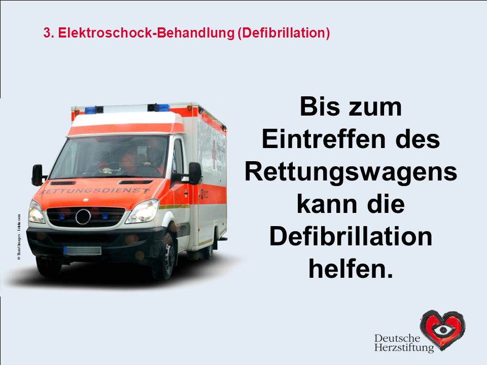 3. Elektroschock-Behandlung (Defibrillation)