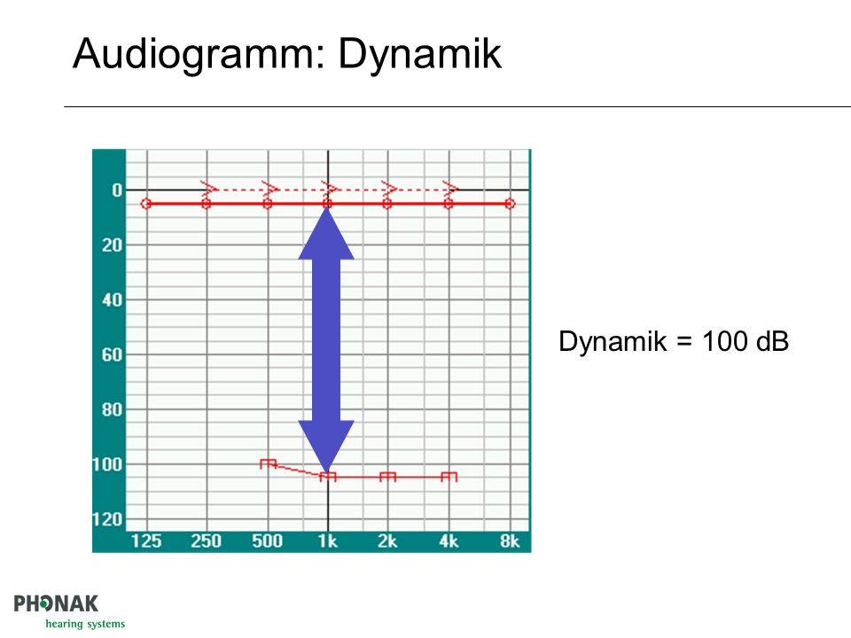 Audiogramm: Dynamik Dynamik = 100 dB