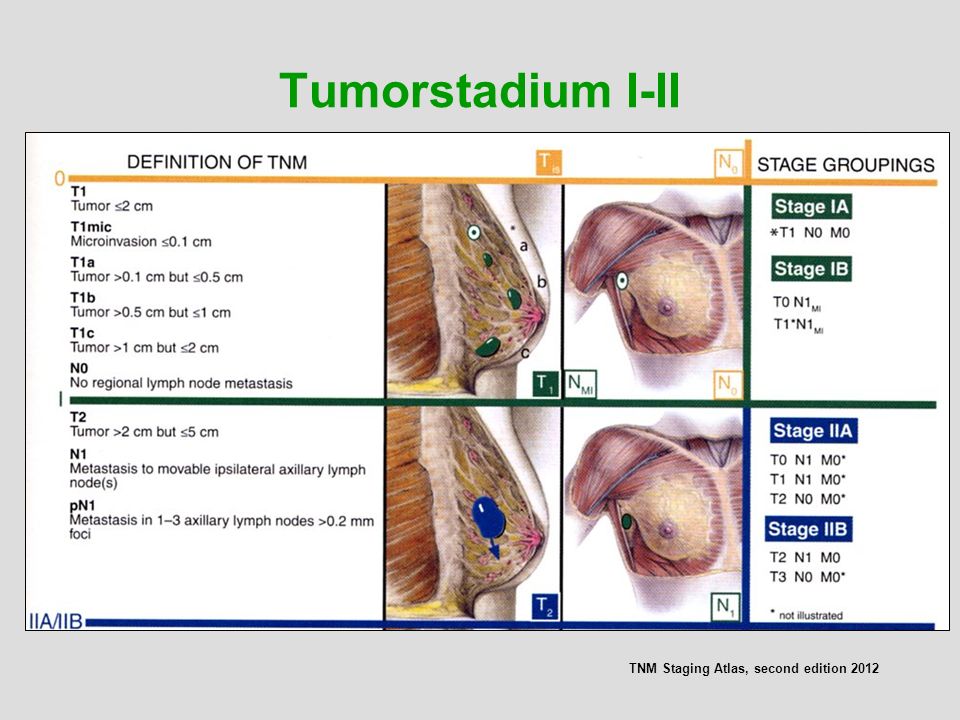 Tumorstadium I-II TNM Staging Atlas, second edition 2012