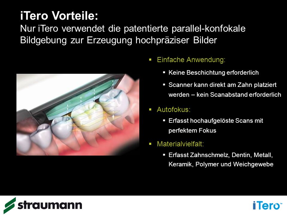 iTero Vorteile: Nur iTero verwendet die patentierte parallel-konfokale Bildgebung zur Erzeugung hochpräziser Bilder