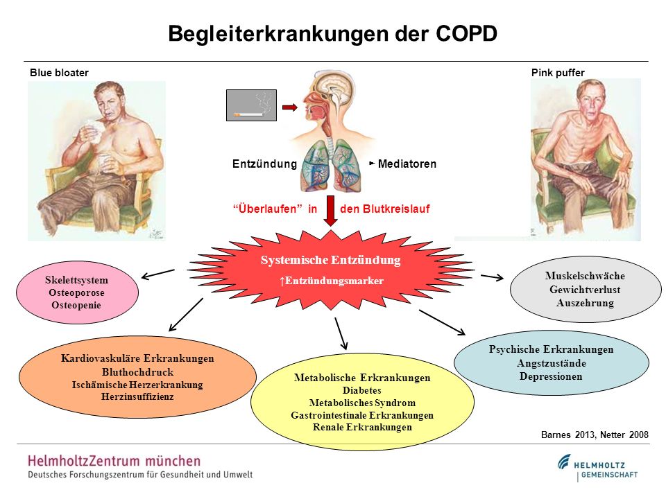 Entstehung und Verbreitung chronisch-obstruktiver Lungenerkrankungen 5 -  ppt herunterladen