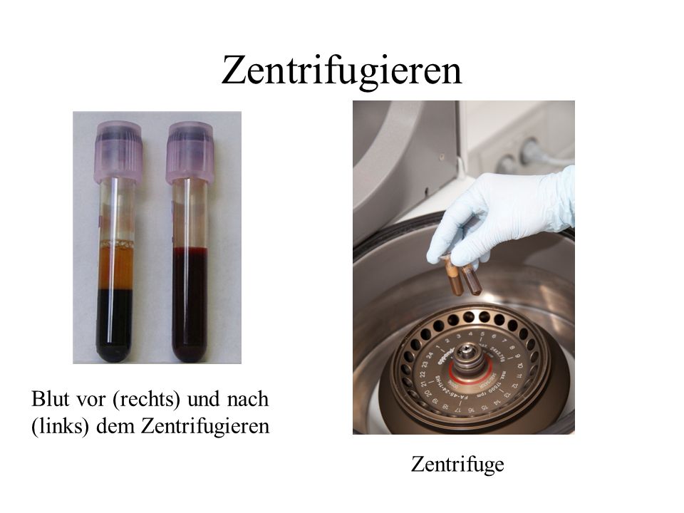 Zentrifugieren Blut vor (rechts) und nach (links) dem Zentrifugieren