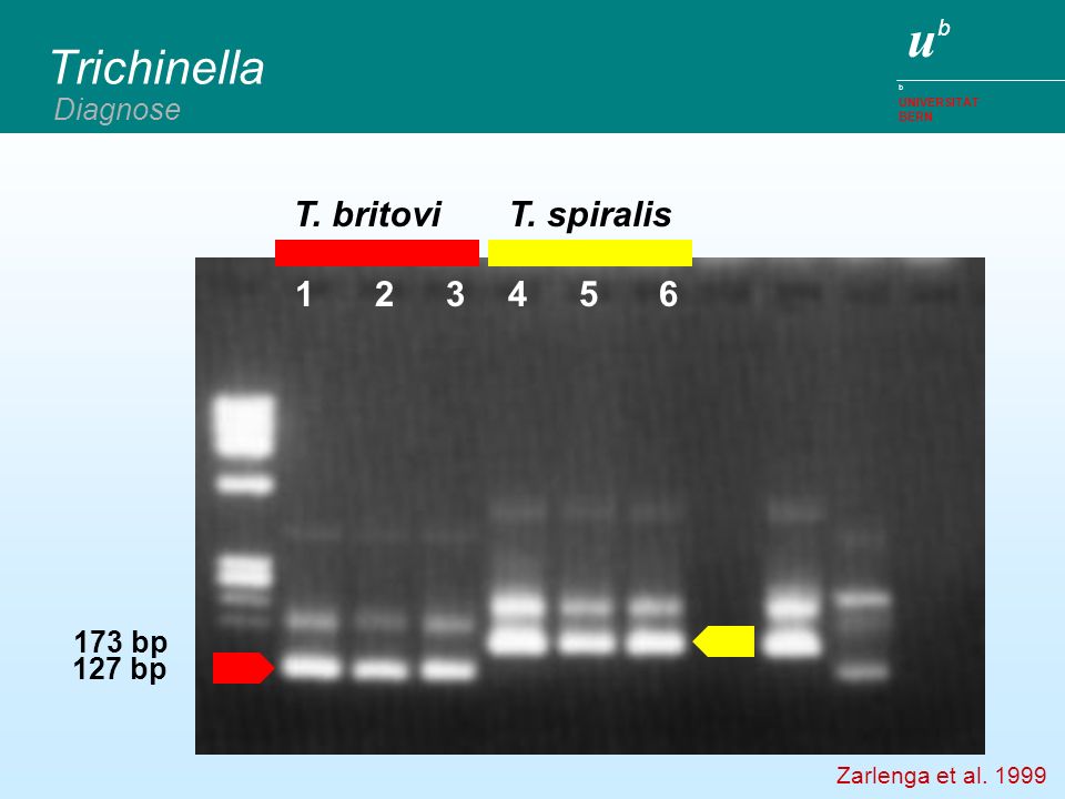 Trichinella T. britovi T. spiralis Diagnose 173 bp 127 bp
