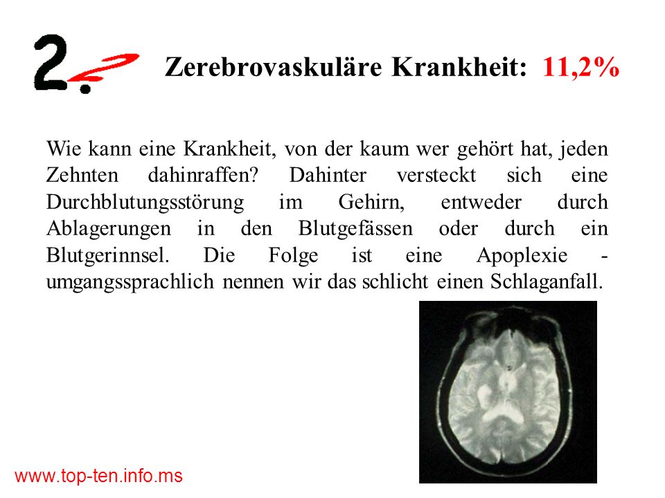 Zerebrovaskuläre Krankheit: 11,2%
