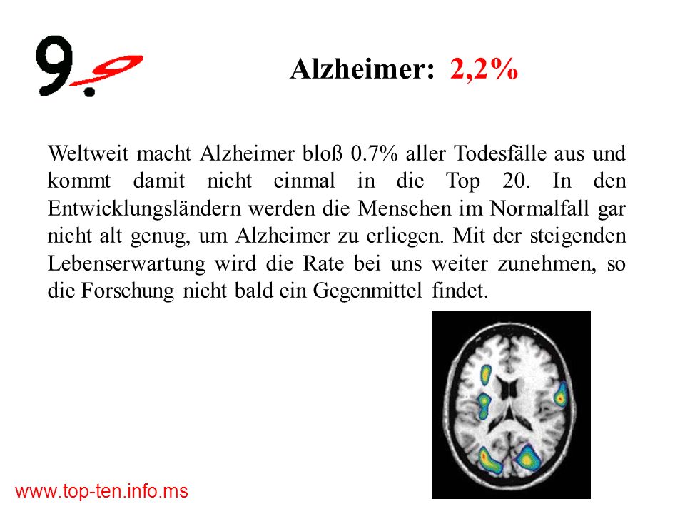 Alzheimer: 2,2%