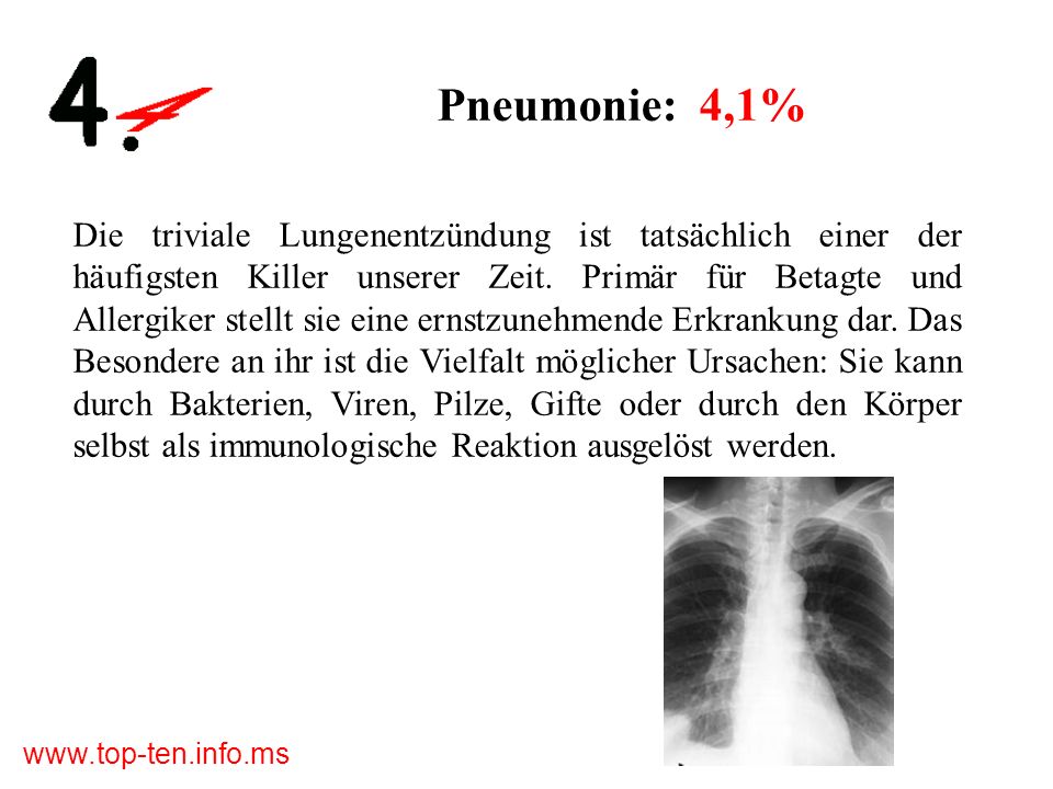 Pneumonie: 4,1%