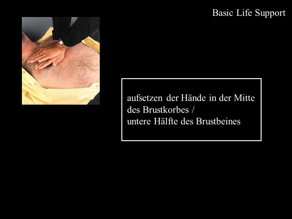 Basic Life Support aufsetzen der Hände in der Mitte des Brustkorbes / untere Hälfte des Brustbeines