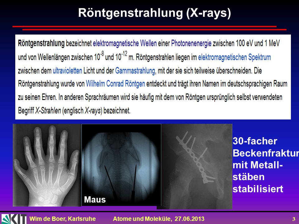 Röntgenstrahlung (X-rays)